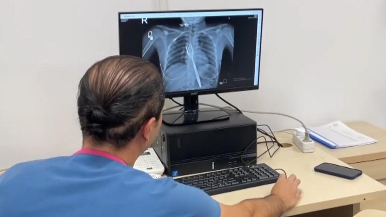 Yuttuğu 18 cm’lik çatal ameliyatla çıkarıldı